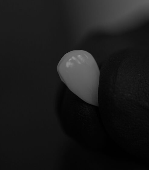 Treatment - Ringway Dental