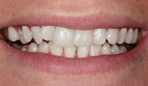 Before - Ringway Dental
