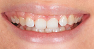 Before - Ringway Dental