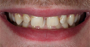 Before - Ringway Dental