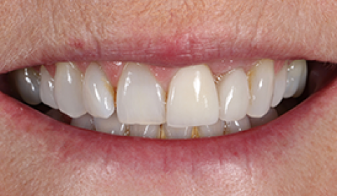 Before - Ringway Dental