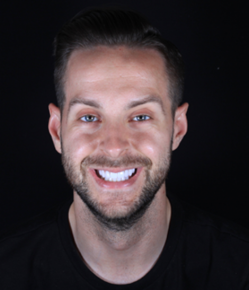 Face - Ringway Dental