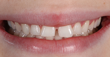 Before - Ringway Dental