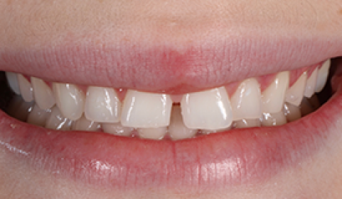 Before - Ringway Dental