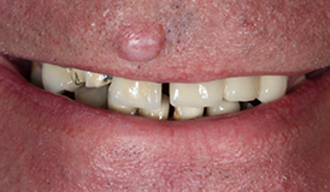 Before - Ringway Dental