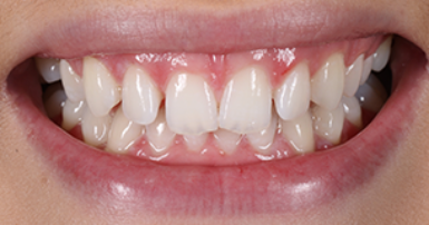 Before - Ringway Dental