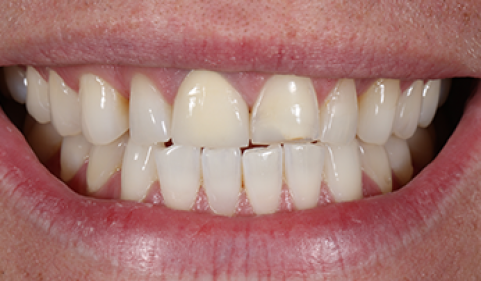 Before - Ringway Dental