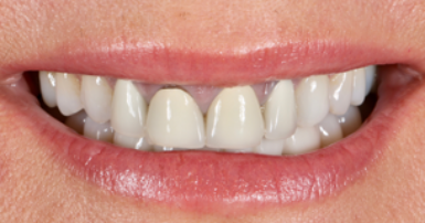 Before - Ringway Dental