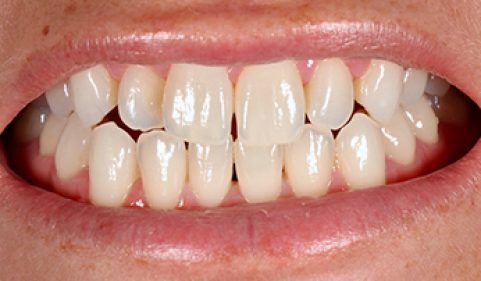 Before - Ringway Dental
