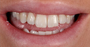 Before - Ringway Dental