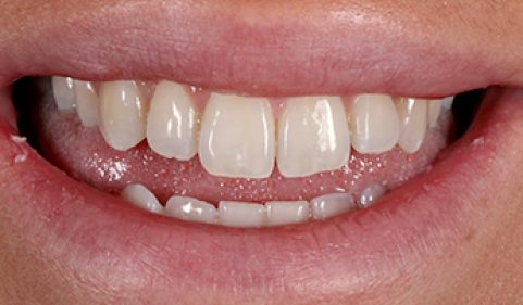 Before - Ringway Dental