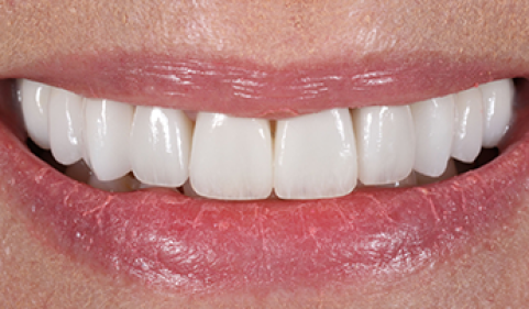 After - Ringway Dental