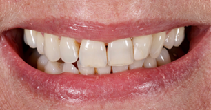 Before - Ringway Dental