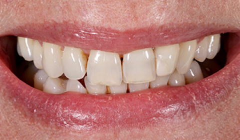 Before - Ringway Dental