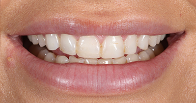 Before - Ringway Dental