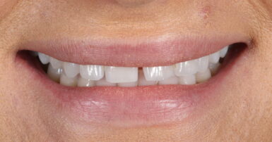 Before - Ringway Dental