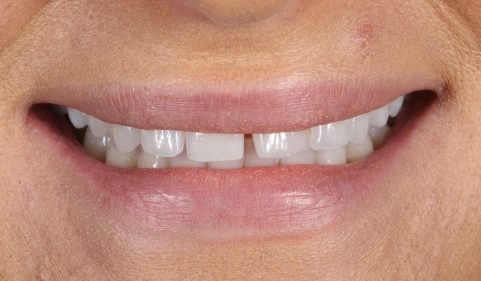 Before - Ringway Dental