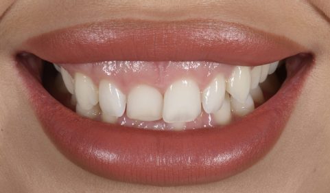 Before - Ringway Dental