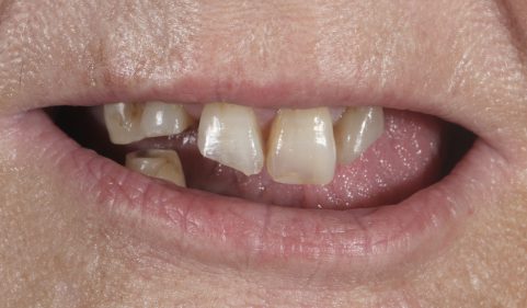 Before - Ringway Dental