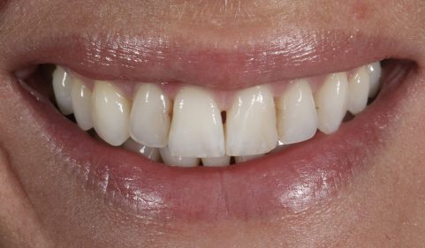 Before - Ringway Dental