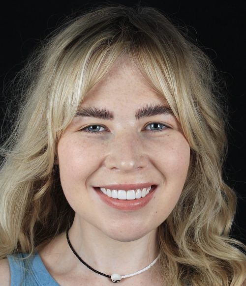 Face - Ringway Dental
