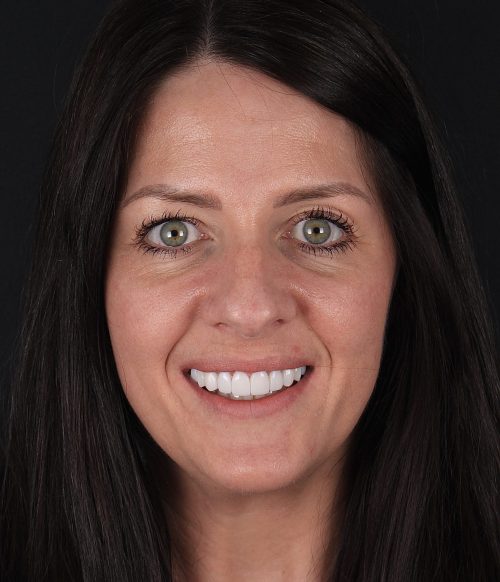 Face - Ringway Dental