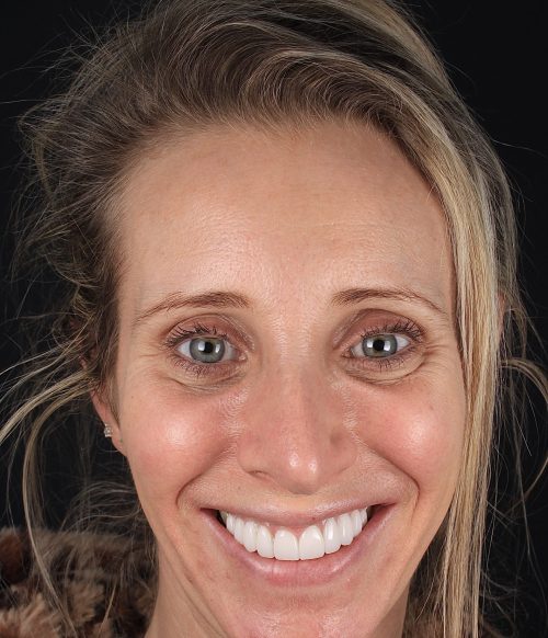 Face - Ringway Dental