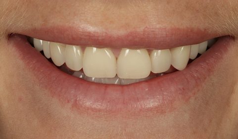Before - Ringway Dental