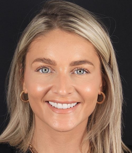 Face - Ringway Dental