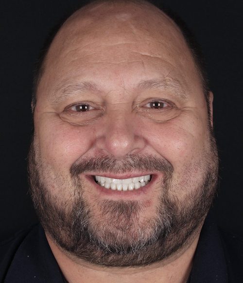 Face - Ringway Dental