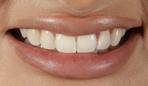 Before - Ringway Dental