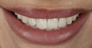 Before - Ringway Dental